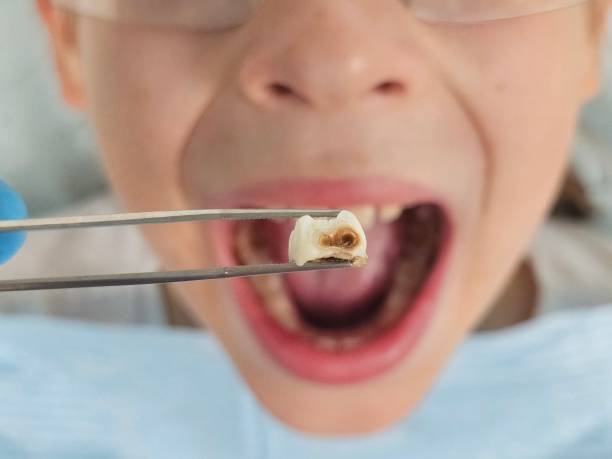 Best Holiday Emergency Dentist in Luck, WI